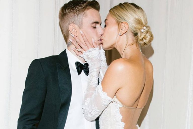 Hailey Baldwin rivela perchè il suo mignolo sinistro sia storto