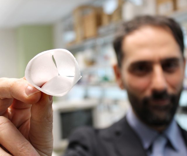 D'Amore e la valvola cardiaca biomimetica. D'Amore e la valvola cardiaca biomimetica.