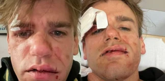 Aggredito lo youtuber Jacopo Malnati del duo Ipantellas Aggressione a Jacopo Malnati