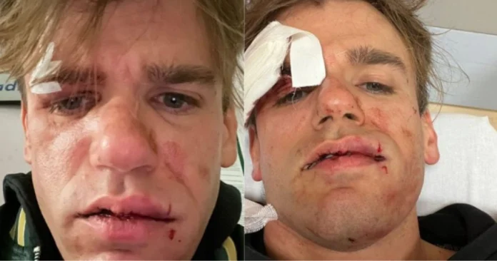 Aggressione a Jacopo Malnati