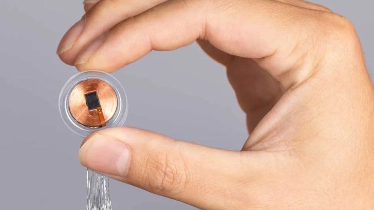 Neuralink: un chip rivoluzionario entra nel cervello umano